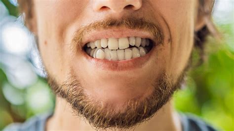 What Your Teeth And Mouth Tell About Your Sleep Quality | OnlyMyHealth