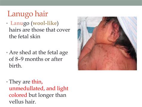 Structure of hair | PPTX