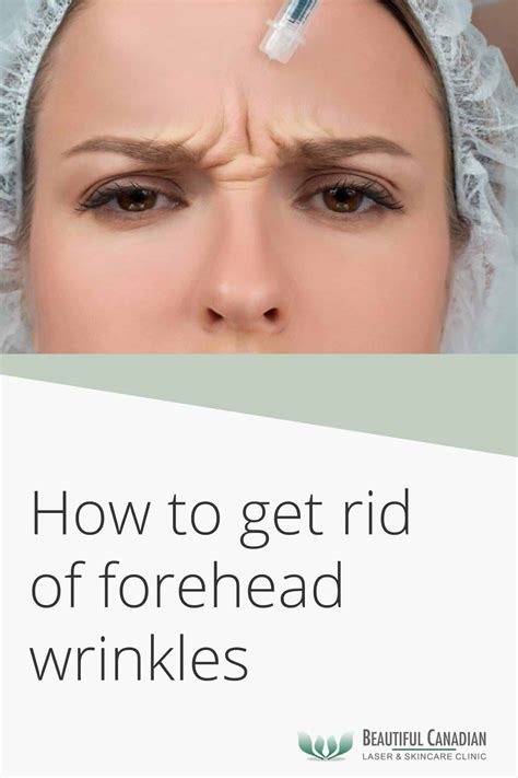 Surrey Forehead Wrinkle Treatments | How to Get Rid of Forehead Wrinkles