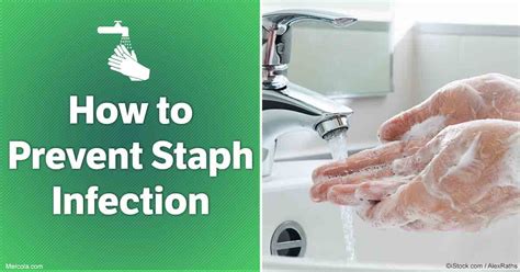 Image result for Prevent