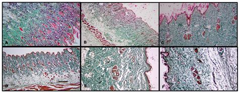 Evaluation of the Effectiveness of Active Vitamin D Use in Experimental ...