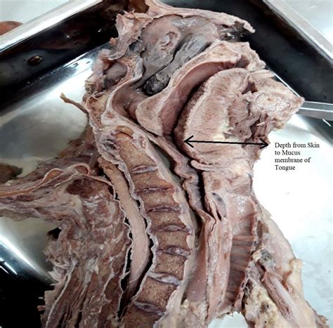 Ultrasound guided airway assessment- an observational study to ...