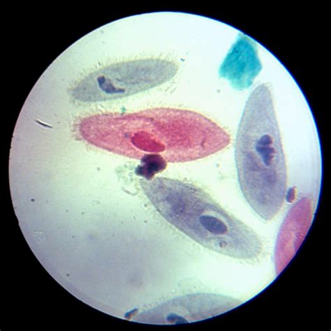 Paramecium Under Microscope - Biology Notes Online