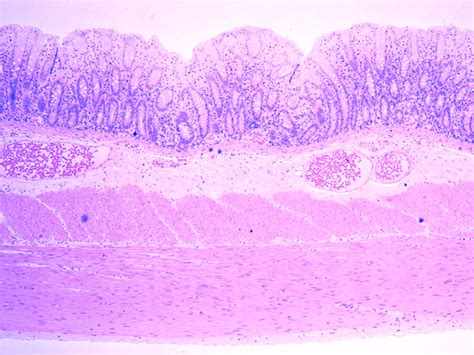 Colenz Colonic 的图像结果