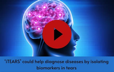 'iTEARS' could help diagnose diseases by isolating biomarkers in tears
