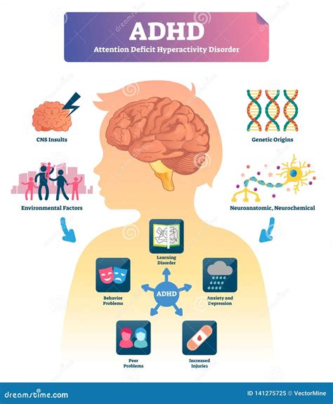 ADHD Vector Illustration. Labeled Mind Attention Deficit Disorder ...