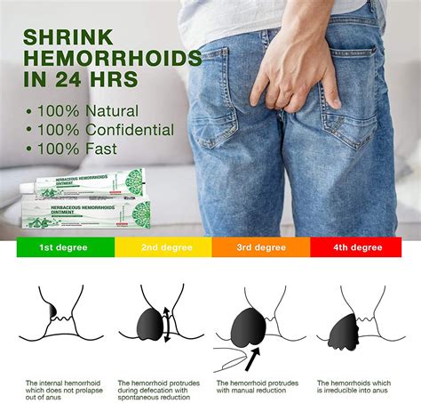 #1 Mejores Crema Para Las Hemorroides Tu Puedes Liberarte Del Dolor Y Sangrado | eBay