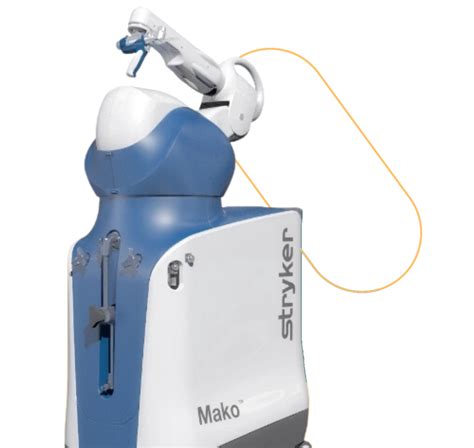 Mako Robotic-Arm Assisted Surgery - Orlando Ortho Surgery Center OOOSC