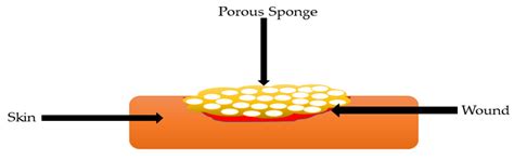 Gelatin-Based Hybrid Scaffolds: Promising Wound Dressings