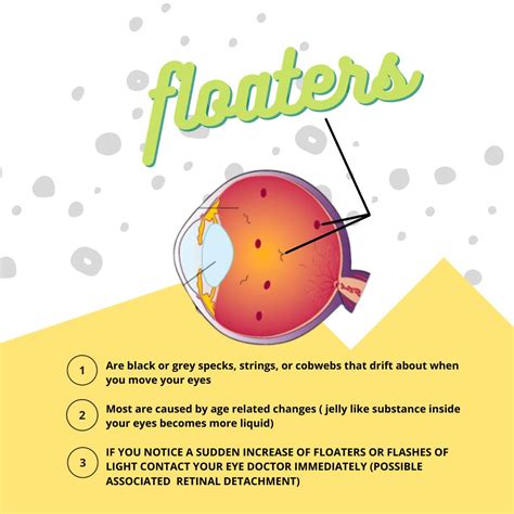 Can You See Floaters? | Eye Facts and Health Tips