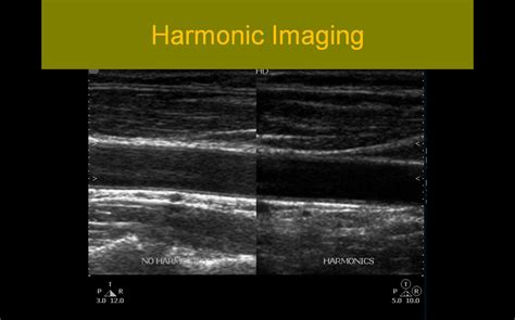 Sonographic Principles and Information Registry Review
