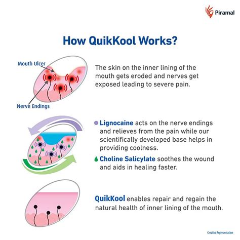 Quik Kool Mouth Ulcer Gel, 10 gm Price, Uses, Side Effects, Composition ...