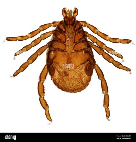 American dog tick (Dermacentor variabilis). Light micrograph (LM) from a whole mount. This ...