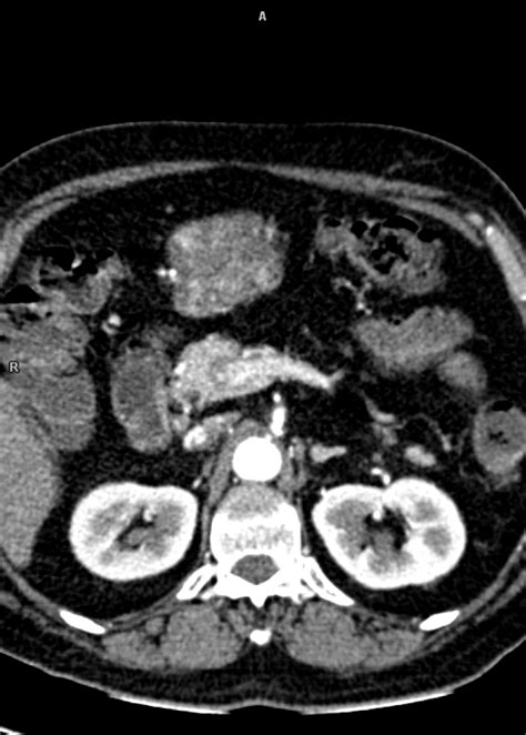Radioloksabha - Articles