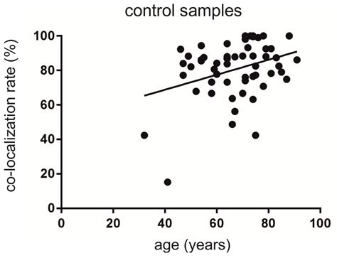 Co-Expression of Nogo-A in Dopaminergic Neurons of the Human Substantia ...