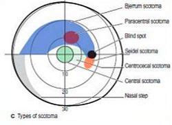 Image result for Visual Field Chart