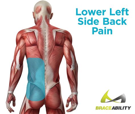 Severe back pain – Artofit