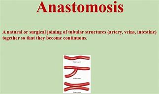 Image result for Anastomosis