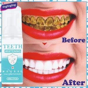 Afflatus Whitening Foam To Removes Bad Breath Fights Germs - Mint ...