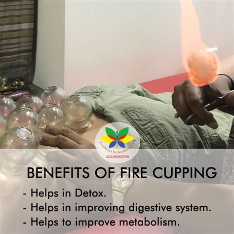 Benefit of fire cupping | Acupuncture by Jasmine Modi