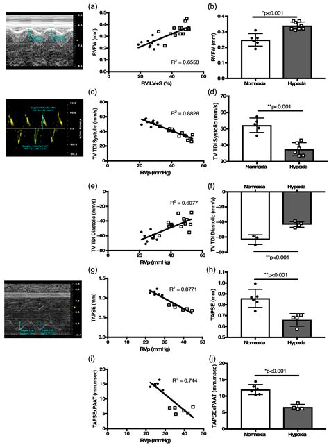 Echocardiographic Assessment of Pulmonary Hemodynamics and Right ...