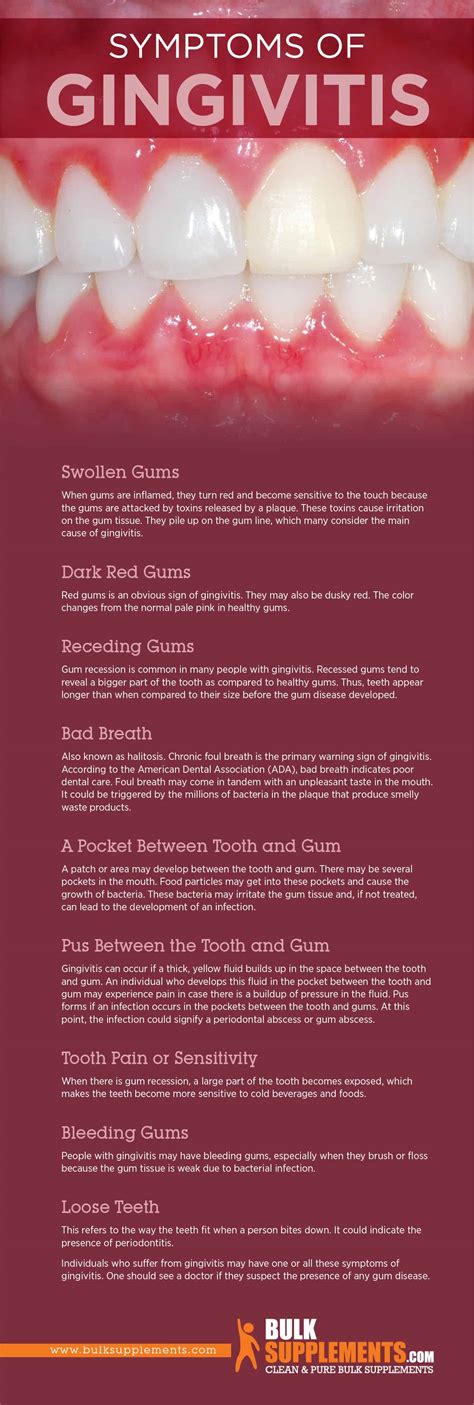 Gingivitis: Symptoms, Causes & Treatment