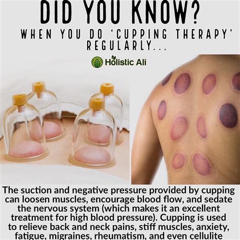 21 Cupping therapy chart ideas | cupping therapy, cupping massage, massage therapy
