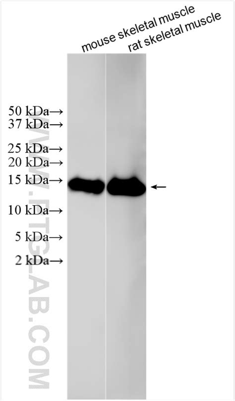 Parvalbumin antibody (29312-1-AP) | Proteintech