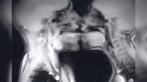 MRI मशीन में कपल का सेक्स, 30 साल पहले हुआ साइंस एक्सपेरिमेंट, बदल गई ...