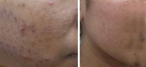 Best Dermatologist/Cosmetologist/skin doctor specialist in sector 14 ...