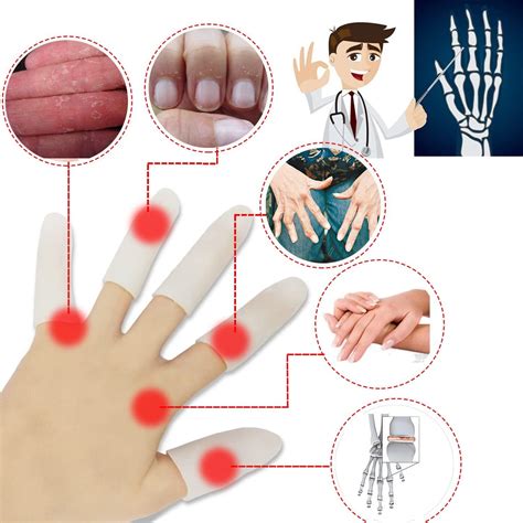 Gel Finger Cots, Finger Protector Support(14 PCS) New Material Finger ...