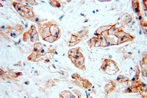 HER2/ErbB2 antibody (51105-1-AP) | Proteintech