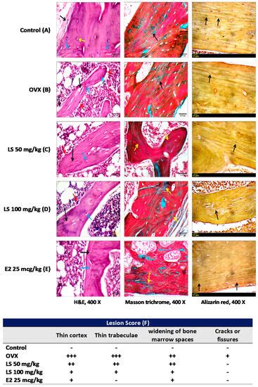 Osteoprotective Activity and Metabolite Fingerprint via UPLC/MS and GC ...