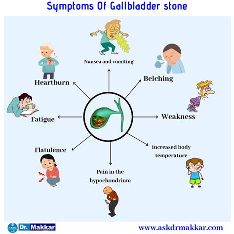 Gallstones cholelithesis Homeopathic Treatment Gall bladder stone remove without surgery proven ...