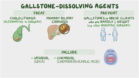 Gallstone-dissolving agents: Nursing pharmacology - Osmosis Video Library