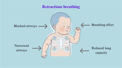 Normal Baby Breathing vs Retractions: Parent Guide - Meredith Plays