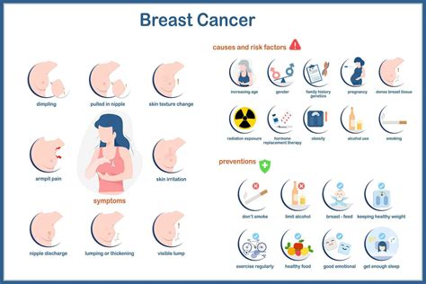 medical infographic ,Vector illustration of breast cancer in flat style.Symptoms of breast ... - how common is breast cancer