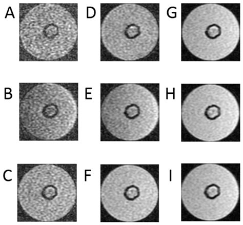 Utility of 1.5 Tesla MRI Scanner in the Management of Small Sample ...