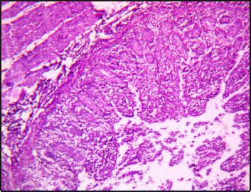 Effect of Eugenia jambolana and Psidium guajava Leaf Meal Mixture ...