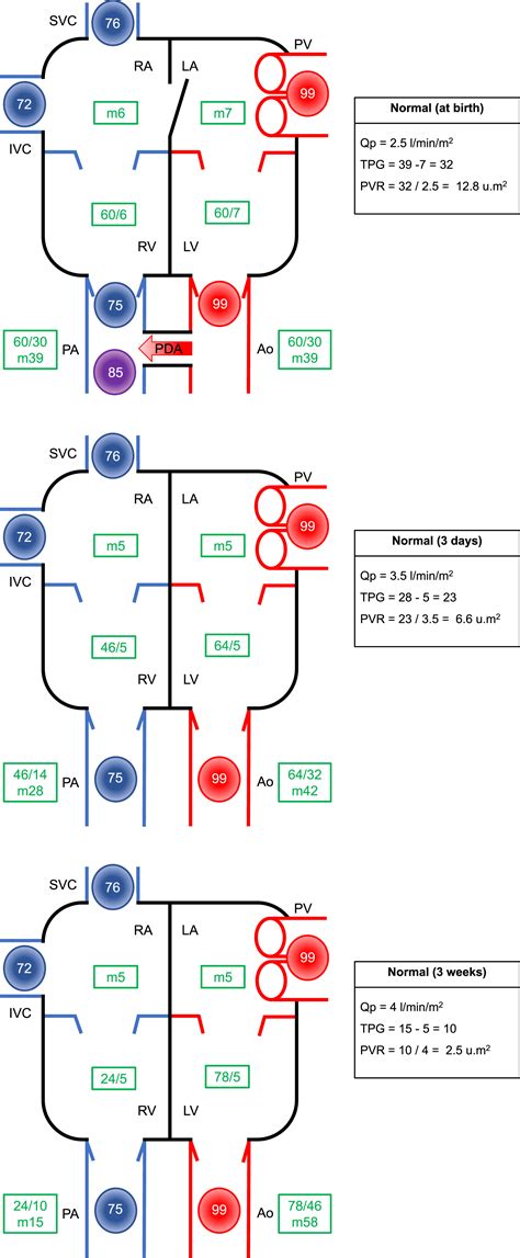The interplay between pressure, flow, and resistance in neonatal ...