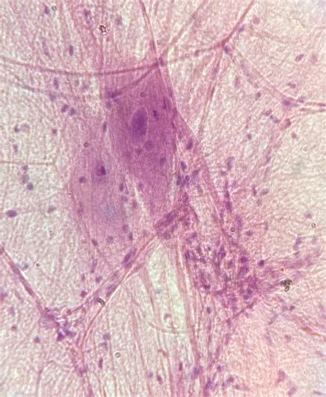 Nervous Tissue under Microscope from Bio Class : r/pics