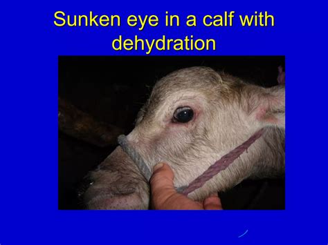 Dehydration | PDF