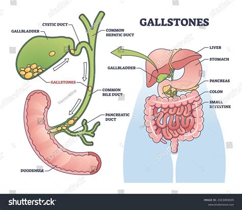Gallbladder Model Labeled Model Of Liver And Gallbladder Diagram
