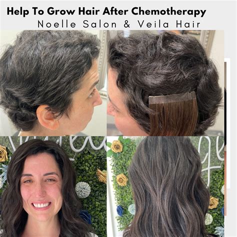 How Fast Can Hair Grow After Chemo at Nicholas Barrallier blog