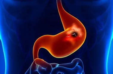 Best Gastroenterology Hospital in Jalandhar | PGI Jalandhar