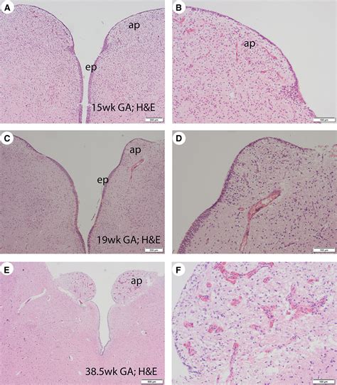 Area Postrema: Fetal Maturation, Tumors, Vomiting Center, Growth, Role in Neuromyelitis Optica ...