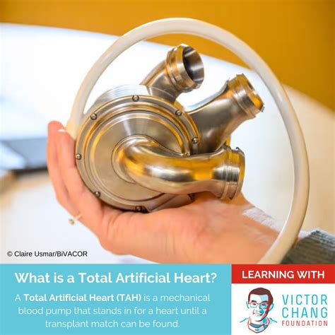 What is a Total Artificial Heart (TAH)? Who knows exactly what a Total… | Victor Chang Foundation
