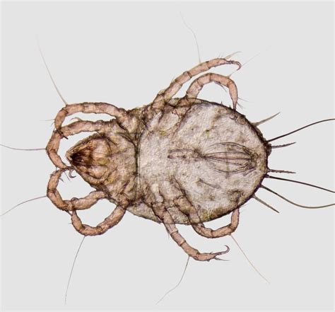 Carpet Mite Bites Treatment - Home Alqu