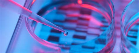 Carrier Testing for Spinal Muscular Atrophy FAQ | UCSF Health