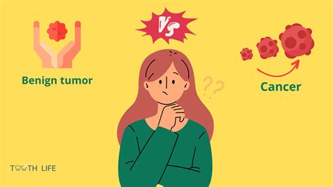 Can Oral Fibroma Turn Into Cancer